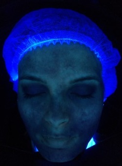huidanalyse UV